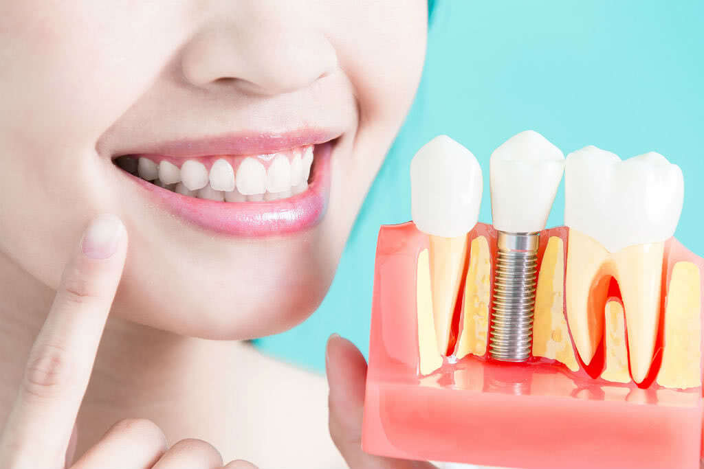 Зубные импланты: противопоказания